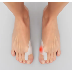 Correcteur hallux valgus sur pieds