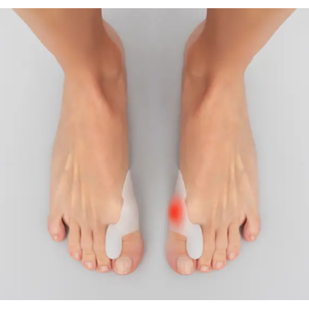 Correcteur hallux valgus sur pieds